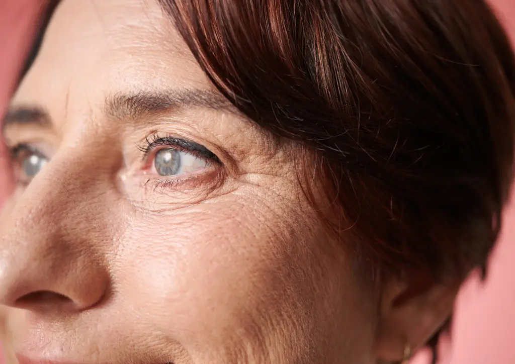Close up of smooth skin around the eye after anti-wrinkle treatment Northampton