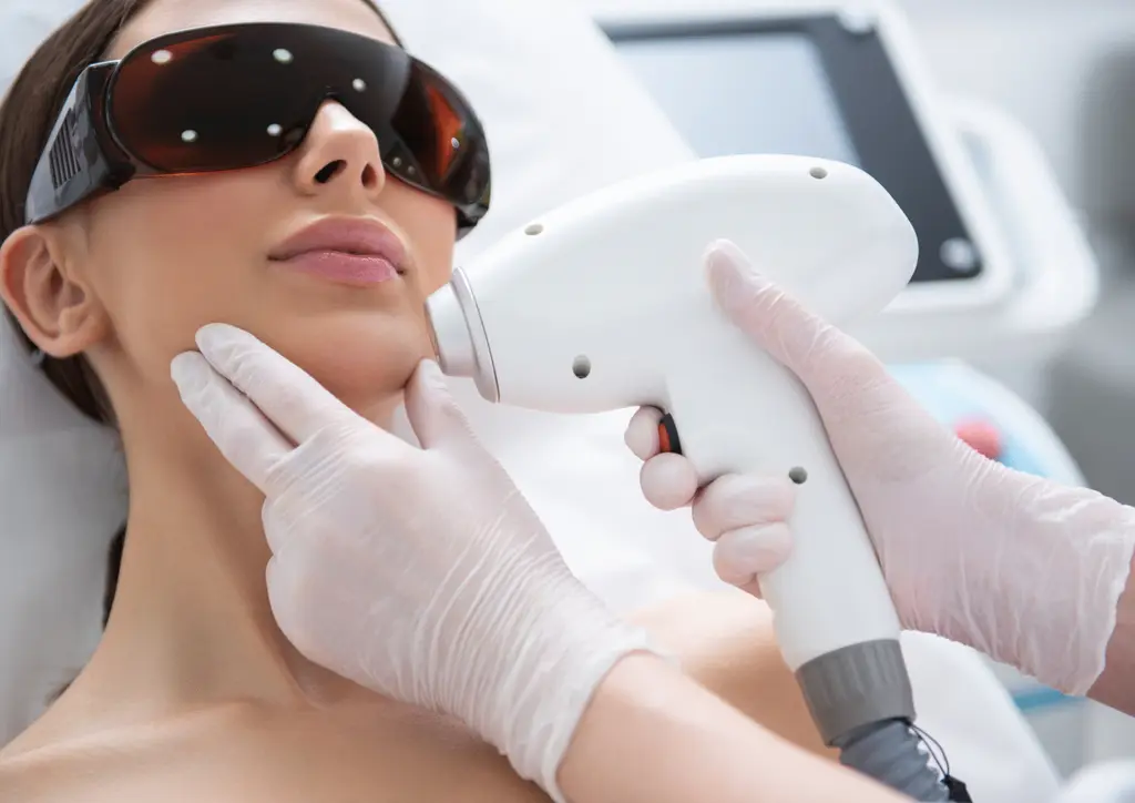 Client wearing protective goggles during an IPL laser treatment Northampton
