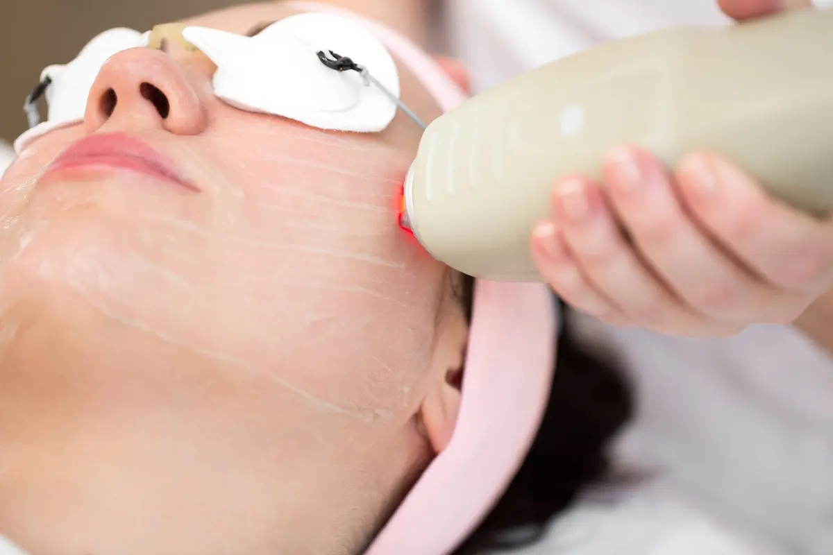 Laser Genesis skin rejuvenation treatment at Inga's Secrets Aesthetics Northampton