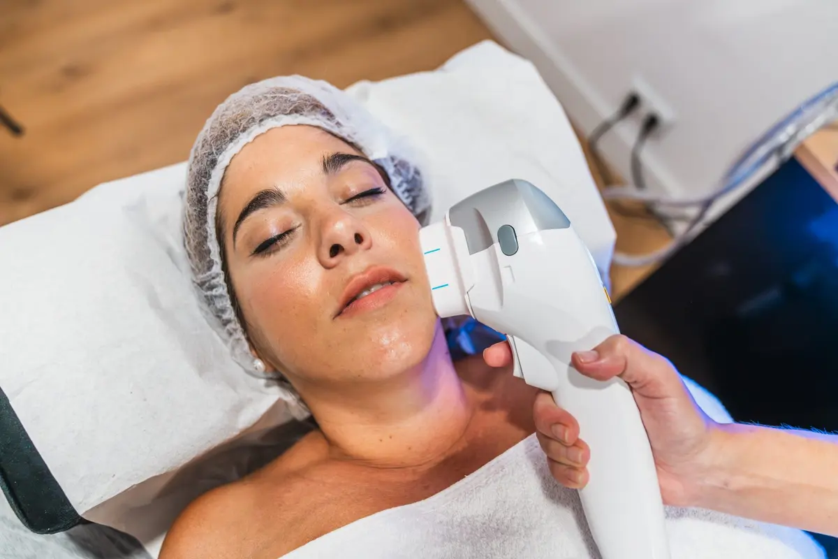 IPL skin resurfacing treatment at Inga's Secrets Aesthetics Northampton