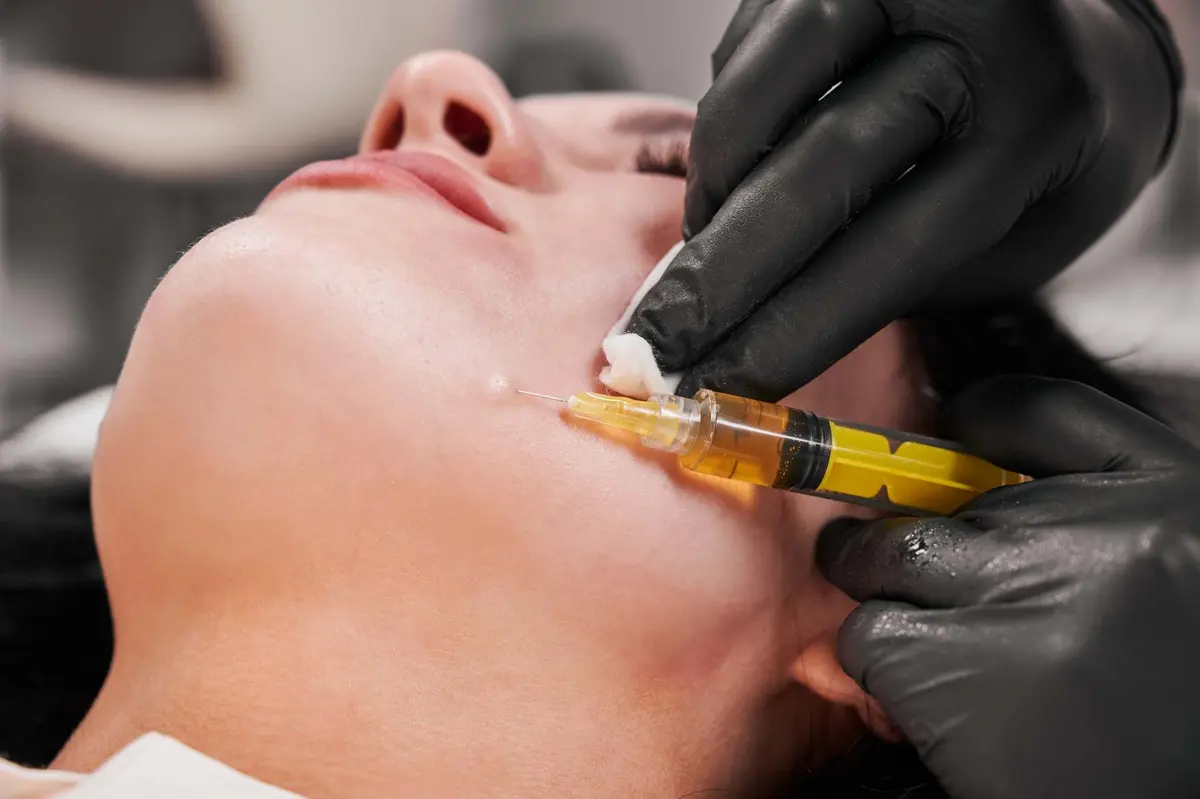 Dermal filler injection to the chin at Inga's Secrets Aesthetics Northampton