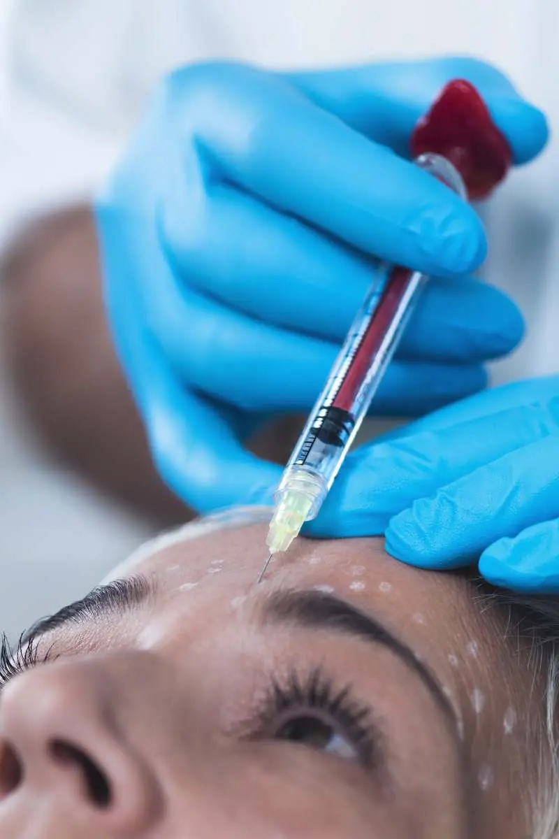 PRP and mesotherapy injection treatment at Inga's Secrets Aesthetics Northampton