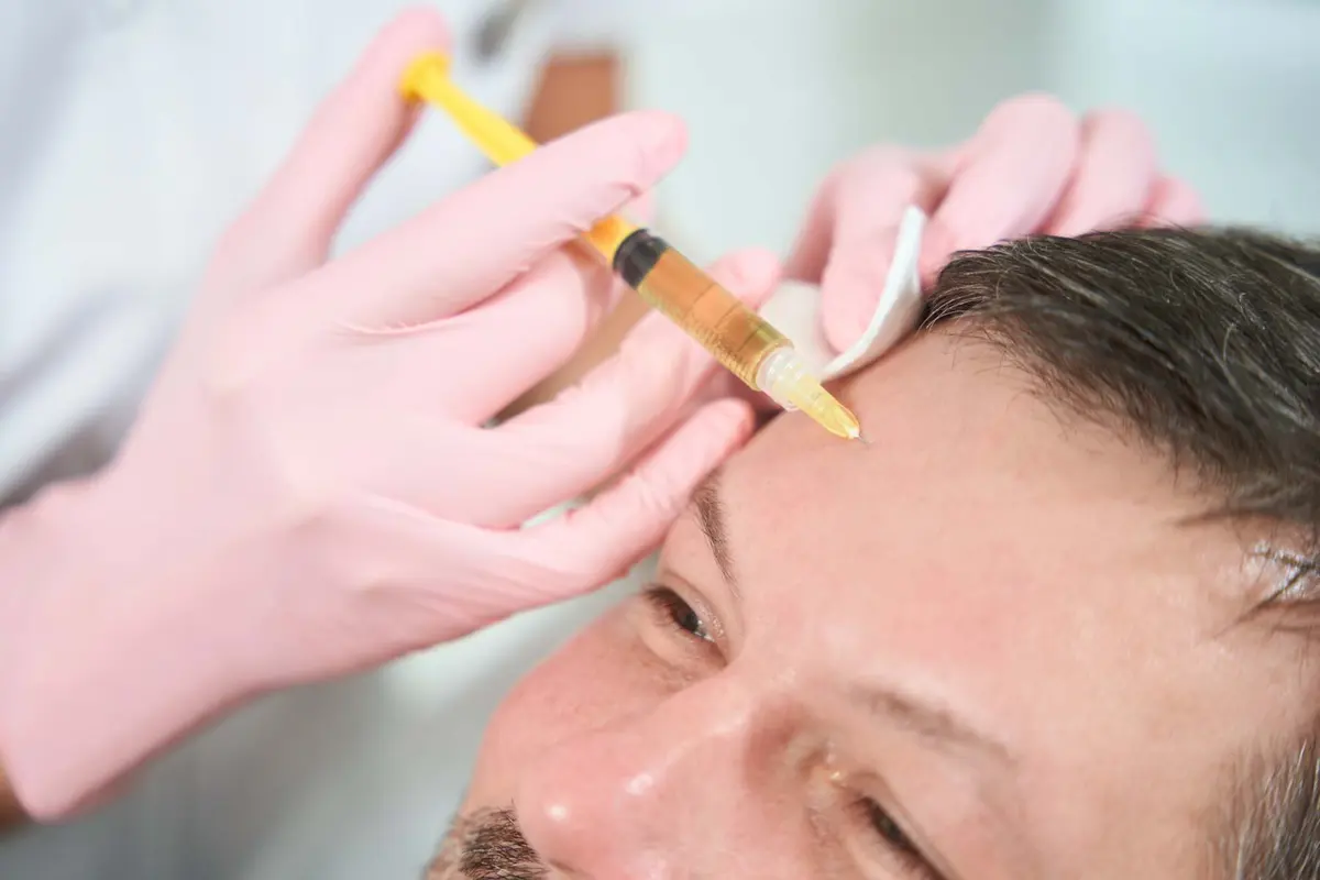 Male client receiving a scalp PRP injection at Inga's Secrets Aesthetics Northampton